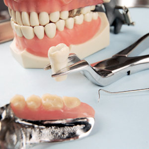 Ортопедическое лечение зубов