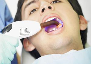  Дефекты зубной эмали – виды и причины возникновения